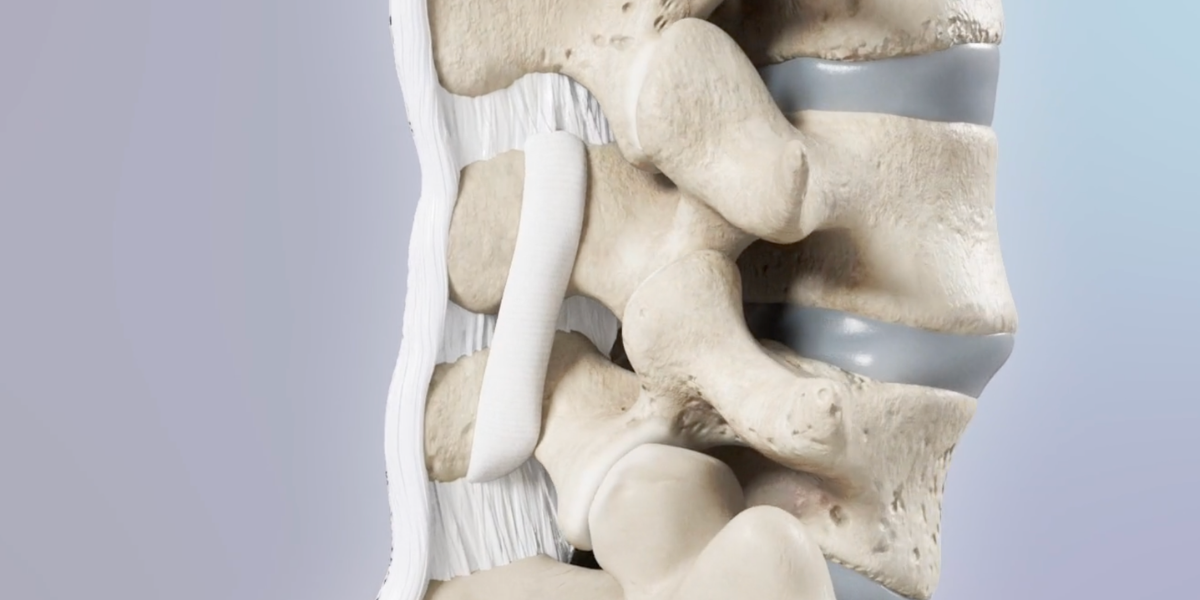 Moving Spine